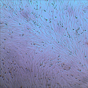 Normal Human Dermal Fibroblasts