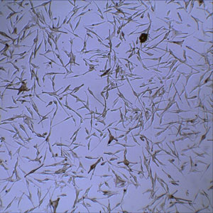 Normal Human Epidermal Melanocytes