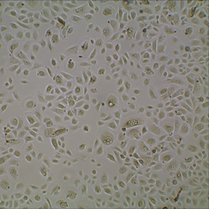 Normal Human Epidermal Keratinocytes