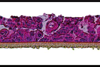 Alveolar epithelium