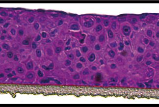 Bladder epithelium