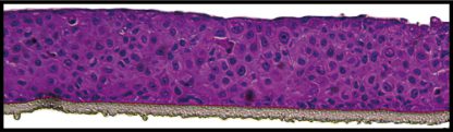 Bladder epithelium