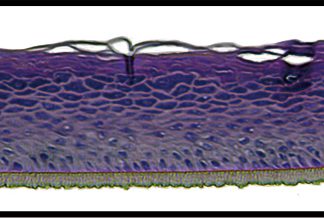 Human Reconstructed Epidermis