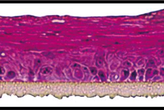 Gingival epithelium