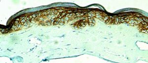 ki67 immunostaining