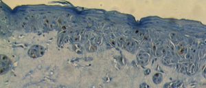 ecaderine immunostaining