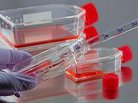 in vitro test kit